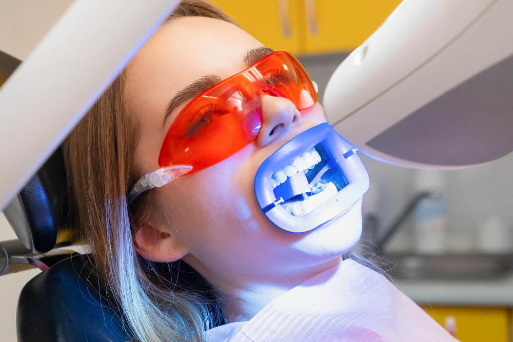Teeth Whitening image